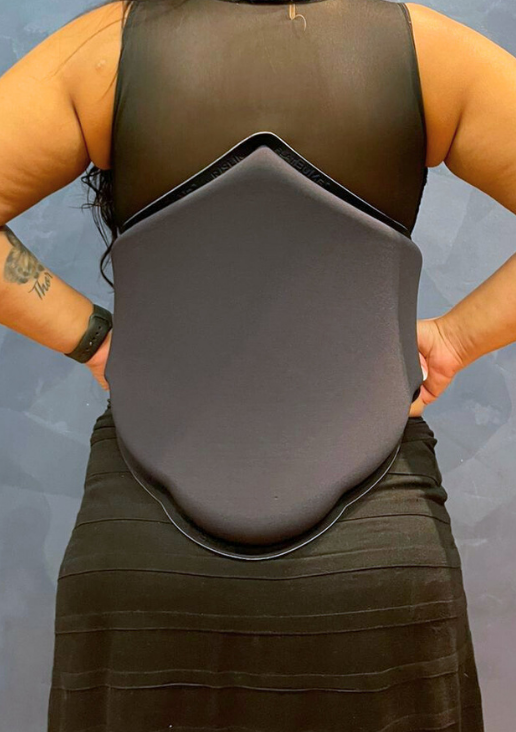 Tala Abdominal IMA FlatBump - TAIMA1